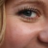 25 Natural Remedies to Cure Under Eyes Wrinkles