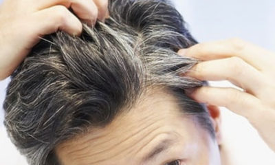12 Effective Home Remedies for Premature Graying of Hairs