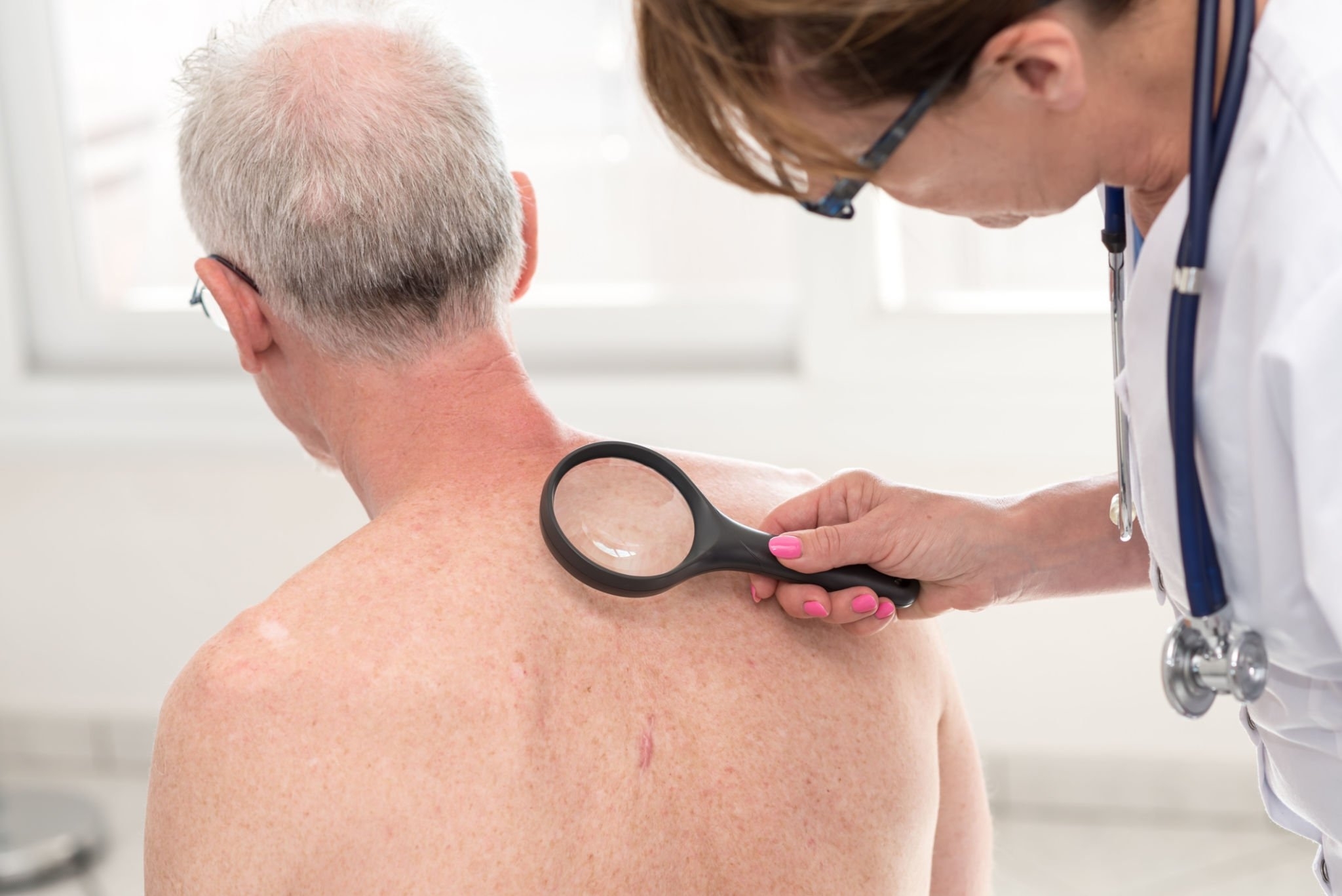 Understanding Melanoma In Situ: What You Need to Know